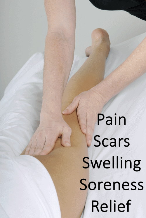 Manual Lymphatic Drainage therapy in Cary NC using gentle Vodder Technique